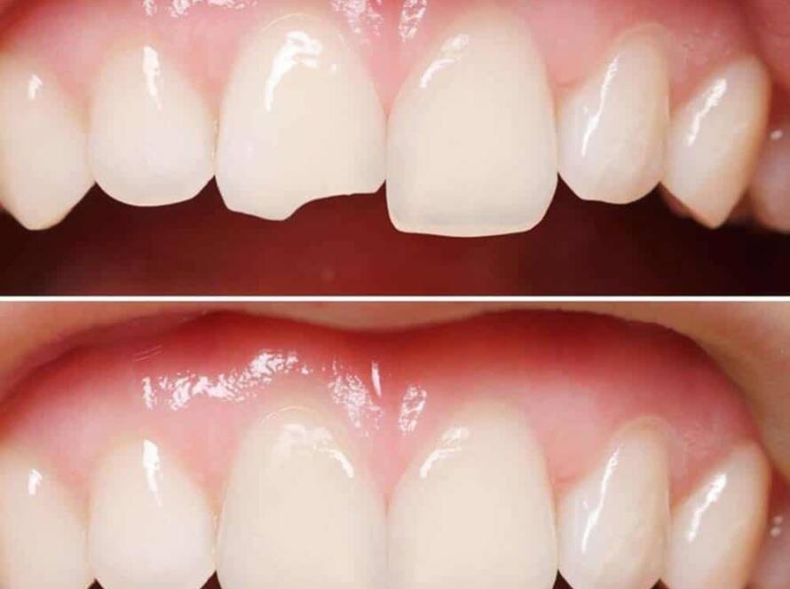 Cosmetic Dentistry